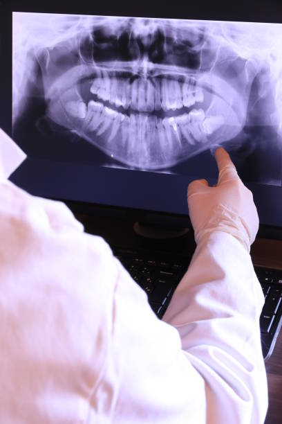 Best Emergency Wisdom Teeth Removal in Huntington Beach, CA